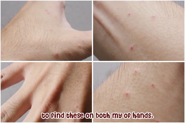 red-marks-image1